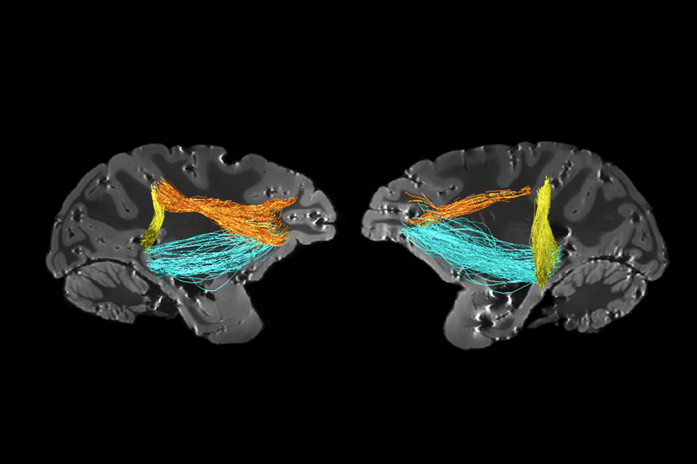 Area PITd is connected to attentional network