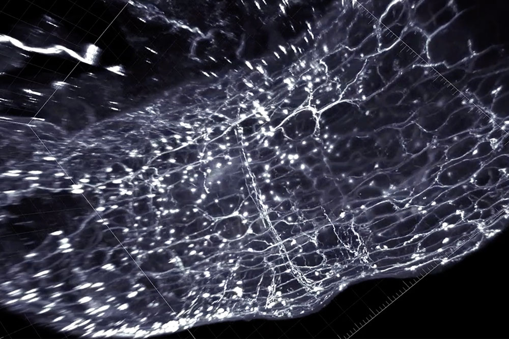 A cross section of the colon with enteric neurons highlighted