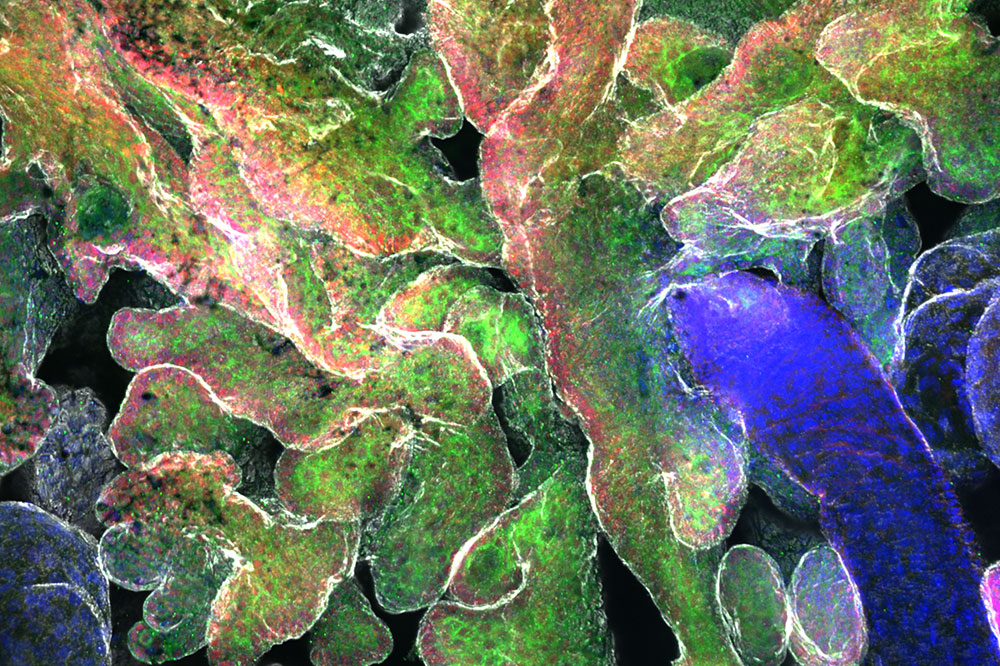Epidermal stem cells