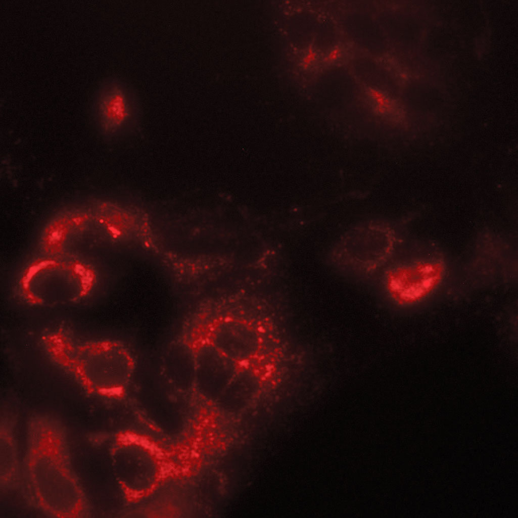 TMEM41B staining