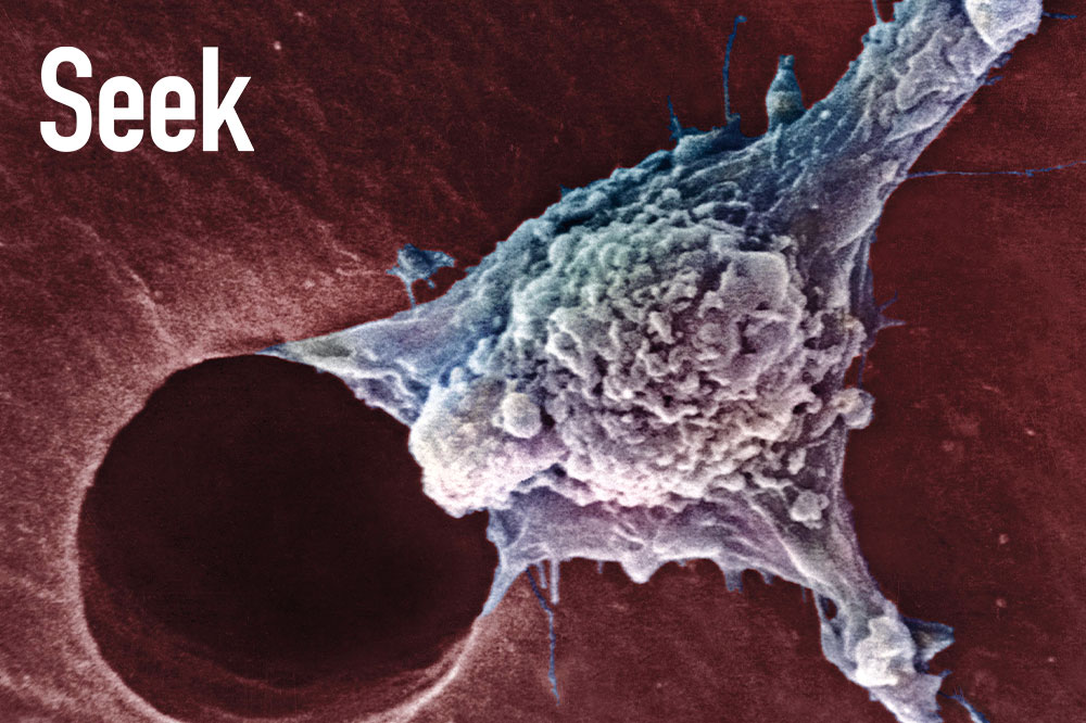 tumor image