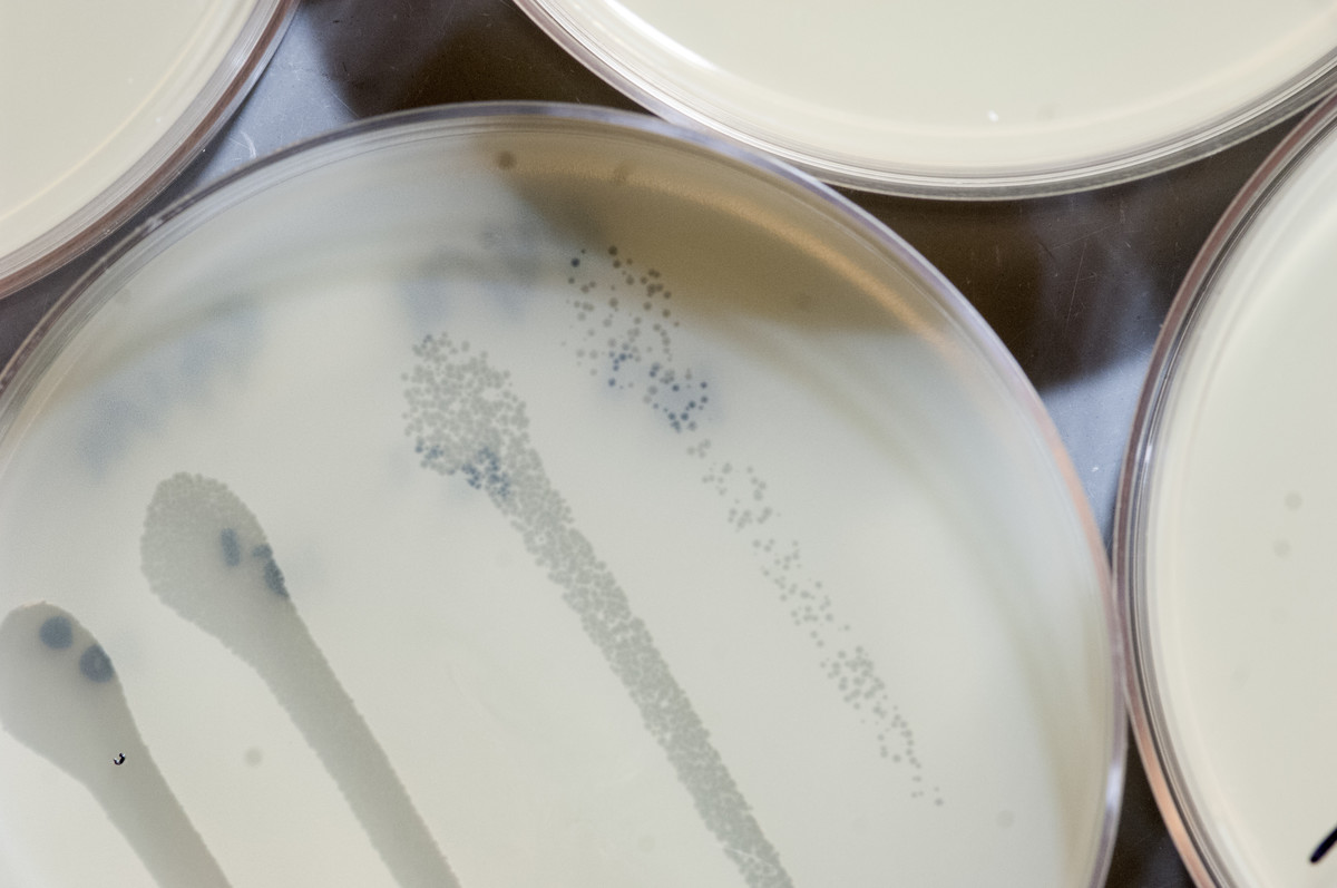 Staphylococcus aureus plaque assay