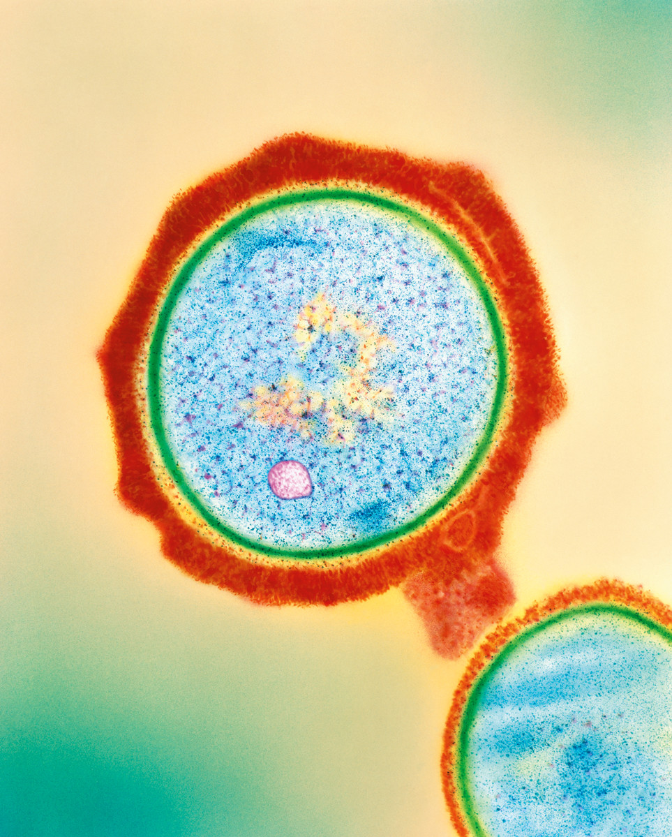 staphylococcus aureus