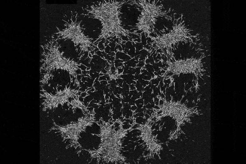 Shyer-cell-ring
