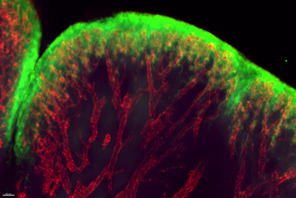 The Rockefeller University » Gum disease may lie at the root of some