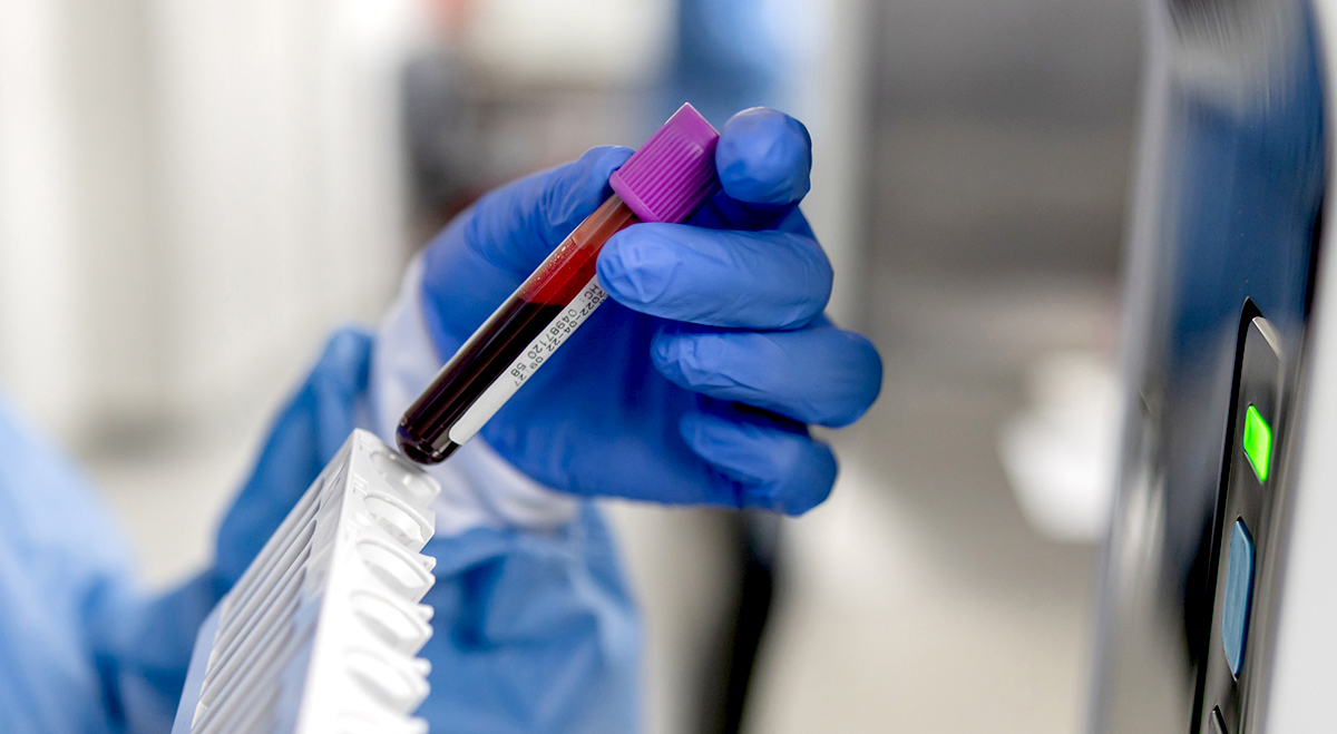 Close-up on a technician analyzing blood samples at the lab
