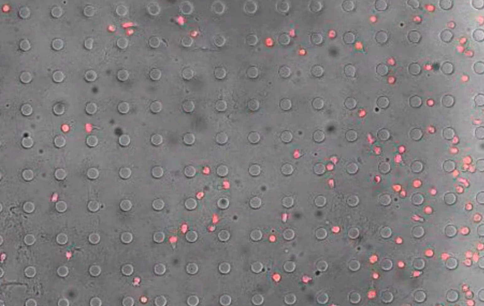 Alveolar macrophages in pink from a sick child on a gray grid