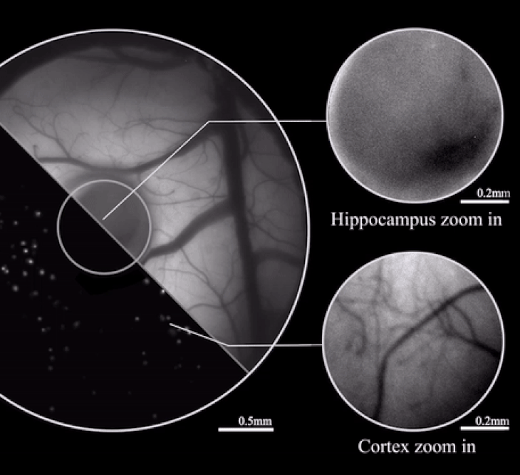 vaziri mouse microscope