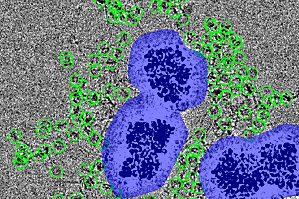 Particles are encircled in green and nanobeads are surrounded by white noise (in blue) on a gray background