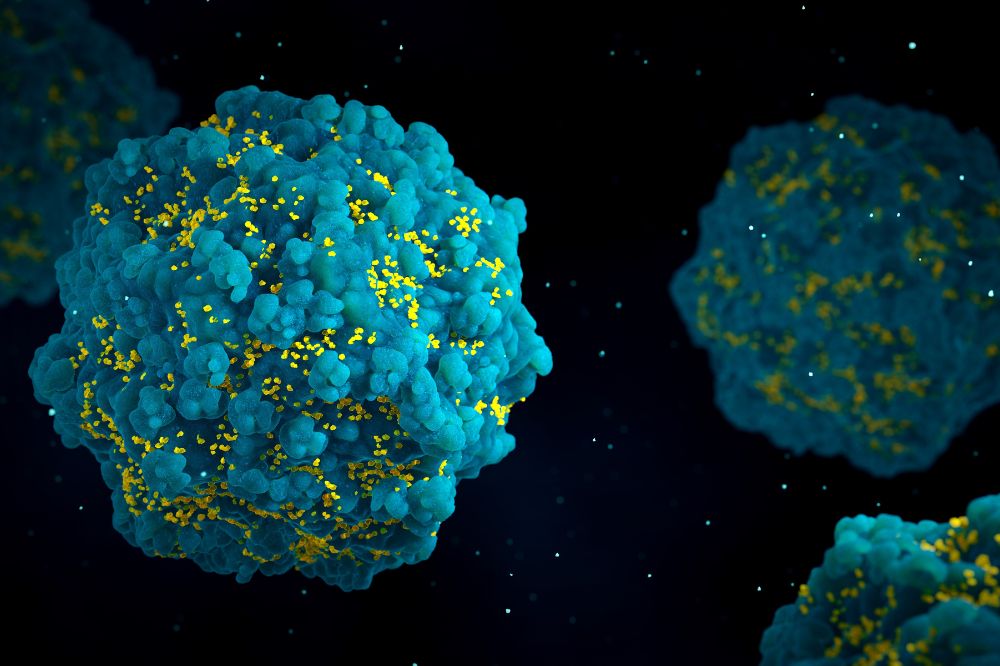 HIV particles emerging from an infected T cell. (Credit: Shutterstock)
