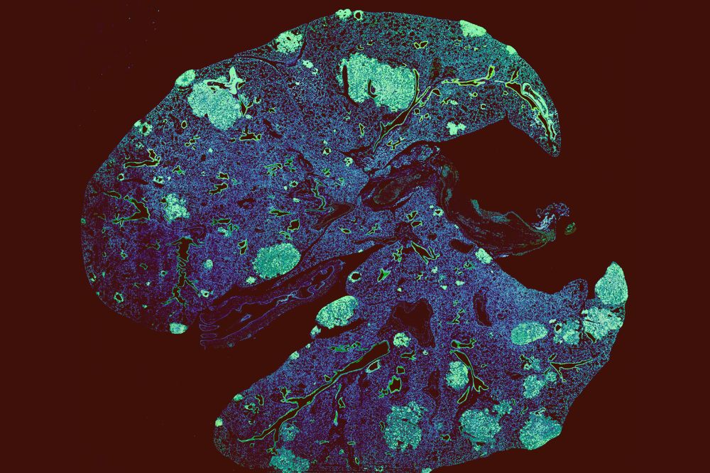 Metastasis in a mouse lung