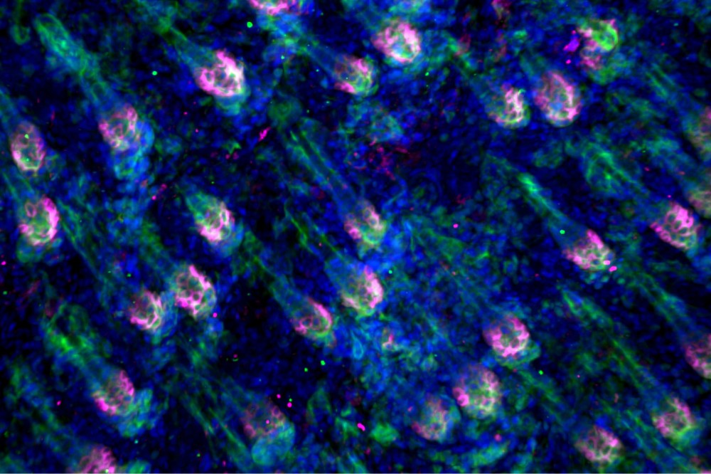 Immunofluorescent microscopy shows hair follicles in the early stages of hair regrowth