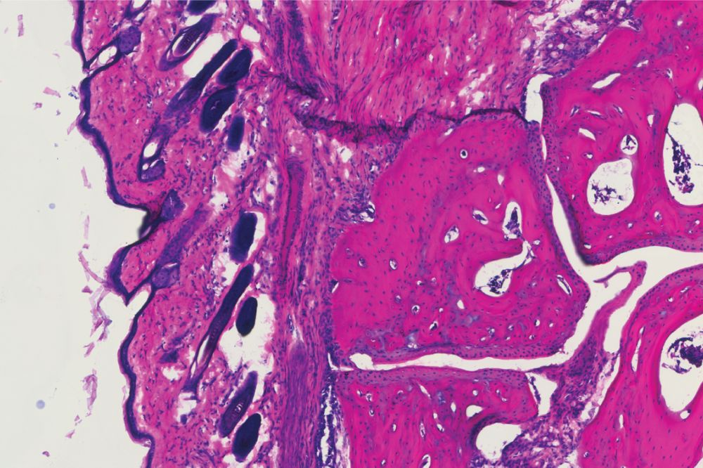A histology showing the ankle joint of a mouse 4 days after receiving the new antibody treatment, V11 sFc