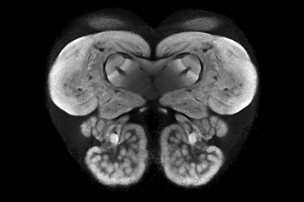 Researchers created this first-of-its kind map by merging 40 ant brains into one.