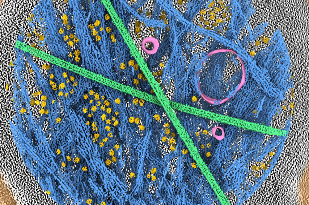 he team used cryo-electron tomography to visualize how forces generated by myosin impact the structure of actin filaments inside cells. (Credit: Alushin lab)