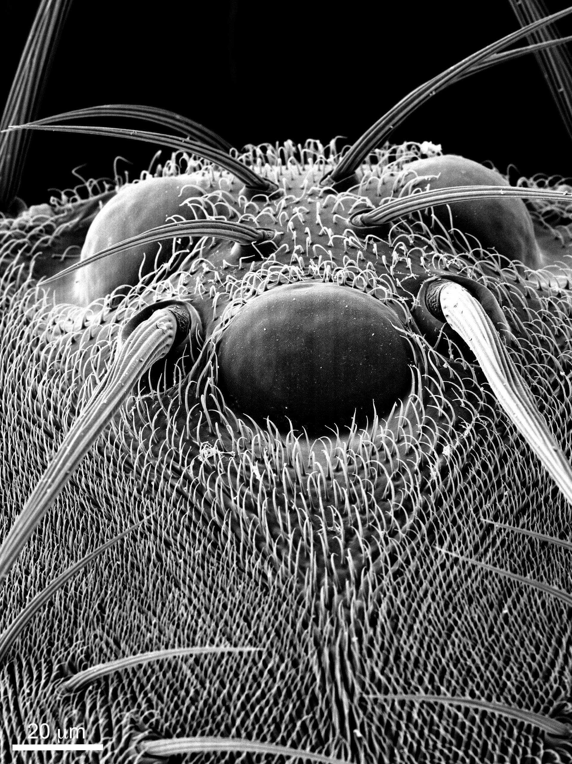 The Rockefeller University Microscope Lab The Rockefeller University » Electron Microscopy Resource Center